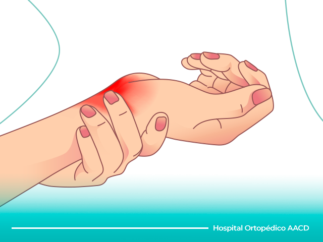 A síndrome do túnel do carpo tem sintomas conhecidos, grande parte da população sabe que dor e formigamento nas mãos são sintomas associados. Leia mais para entender as causas e o tratamento
