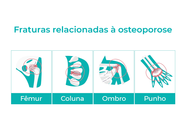 ilustração com desenhos de fraturas relacionadas à osteoporose.