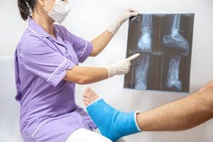 Médica mostra raio-x de pé quebrado para paciente.