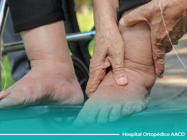 Card de pessoa idosa com as mãos nos pés inchados e ressecados do diabetes.