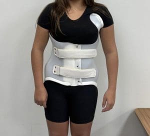 Paciente usando colete Conceito Rigo para tratamento da escoliose visto de frente