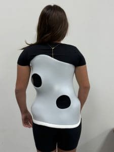 Paciente usando colete Conceito Rigo para tratamento da escoliose visto de costas.