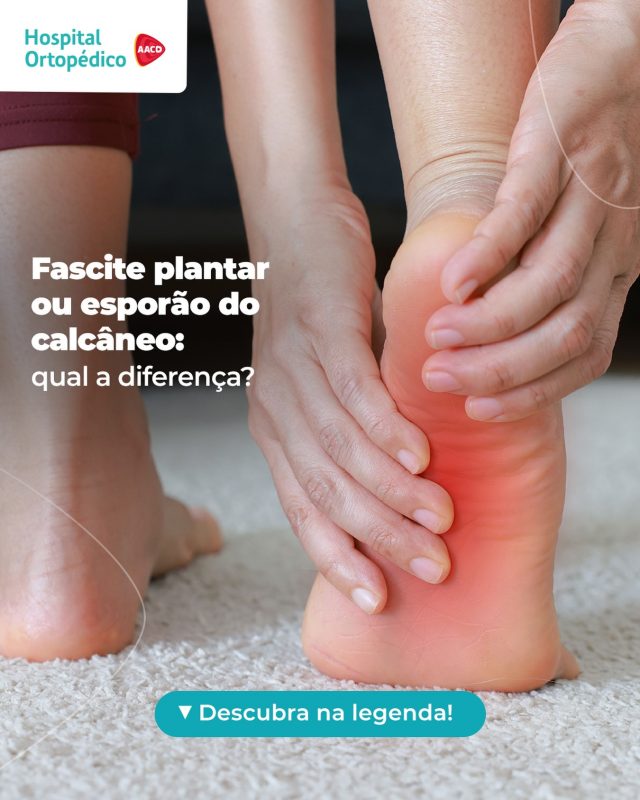 ⚠️ Fascite plantar e esporão do calcâneo não são a mesma coisa!​

🔍 A fascite plantar é a inflamação da fáscia, uma faixa de tecido localizada na parte inferior do pé. Ela se estende da região do calcanhar em direção aos dedos e ajuda na sustentação do arco do pé durante atividades como caminhar e correr.​

👣 Já o esporão é uma formação óssea que se desenvolve na base do calcanhar.​

🏥 Sente dores no calcanhar ou na sola do pé ao caminhar? Agende uma consulta com a nossa equipe especializada em pé e tornozelo.​

✅ Atendemos particular e convênios. ​
 ​
📲 Consulta com hora marcada. Agende pelo WhatsApp (11) 5576-0777 ​
​
📍 Avenida Professor Ascendino Reis, 724 – Ibirapuera, São Paulo – SP ​
​
RT: Dra. Renata Menegazzi dos Santos (CRM/SP: 113163) ​