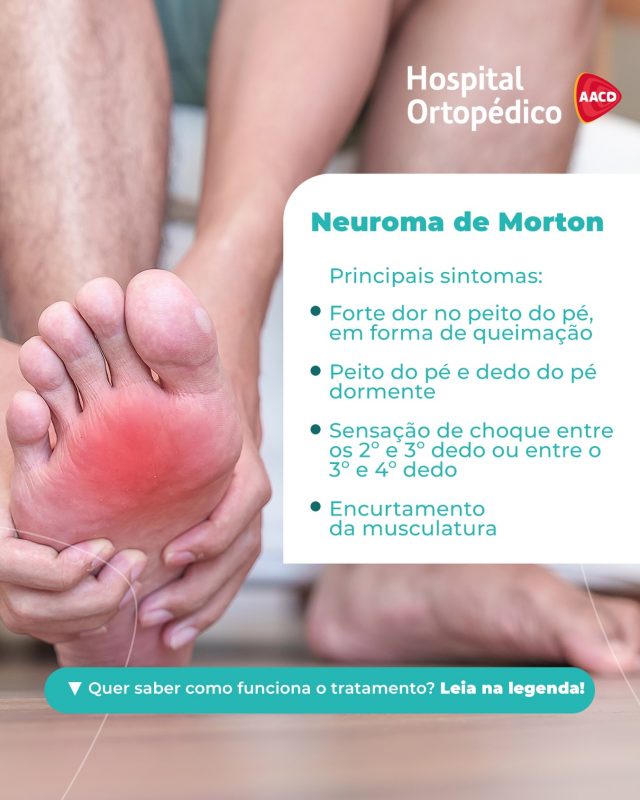 👣 O neuroma de Morton é o espessamento do tecido do nervo, causando a formação de um caroço ao redor dele. 

🦶🏾É mais comum aparecer entre o segundo e terceiro dedo ou entre o terceiro e o quarto. Pode provocar dores, queimação e desconforto ao caminhar.​

↪️ As causas variam: Além de pessoas com deformidades no pé terem um risco maior de desenvolver o neuroma, o uso de calçado inadequado e a prática de atividade física de impacto repetitivo na parte anterior do pé podem contribuir para o desenvolvimento da patologia.​

🔍 O tratamento conservador envolve a mudança de calçado, o uso de palmilhas ortopédicas, anti-inflamatórios, injeções de corticosteroides e fisioterapia para fortalecimento da musculatura. Em casos mais graves, pode ser indicado o tratamento cirúrgico.​

🏥 Sente dores ou queimação na sola do pé? Não adie a sua avaliação. Marque uma consulta com os nossos especialistas em pé e tornozelo! ​
 ​
📲  Atendemos particular e diversos convênios com hora marcada. Agende pelo WhatsApp (11) 5576-0777 ​
​
📍 Avenida Professor Ascendino Reis, 724 – Ibirapuera, São Paulo – SP ​

RT: Dra. Renata Menegazzi dos Santos (CRM/SP: 113163) ​