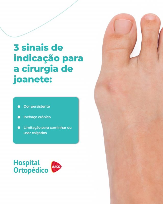 Você sabe quando a cirurgia de joanete é realmente necessária?​ 🤔

❗O joanete é uma deformidade que altera o alinhamento do dedão e dos ossos da frente do pé. Mas nem todo caso precisa de cirurgia!​

👣 Se a saliência óssea não causa dor nem limitação, a intervenção cirúrgica geralmente não é necessária.​

🏥 Sentindo desconforto nos pés? Consulte nossos ortopedistas para avaliar o seu caso e indicar o tratamento ideal. ​

✅ Atendemos particular e convênios. ​
 ​
📲 Consulta com hora marcada. Agende pelo WhatsApp (11) 5576-0777 ​

📍 Avenida Professor Ascendino Reis, 724 – Ibirapuera, São Paulo – SP ​

RT: Dra. Renata Menegazzi dos Santos (CRM/SP: 113163)