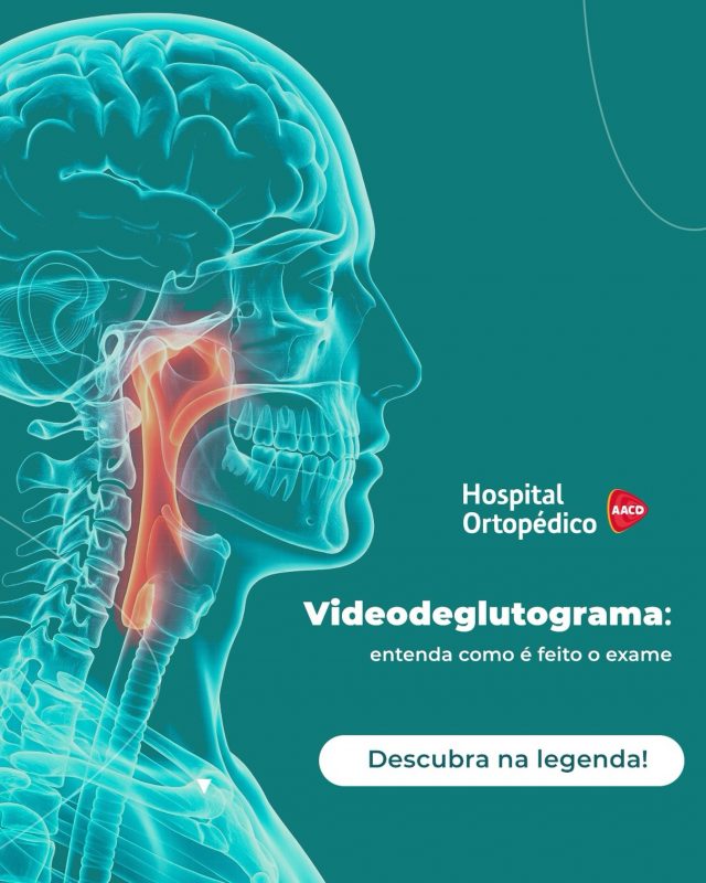 ❗️Sente engasgos frequentes ou dificuldade para engolir? O videodeglutograma pode ajudar a identificar o motivo disso!​

🔍 Apesar do nome parecer difícil, o objetivo do exame é simples: identificar com precisão as causas da disfagia (dificuldade de deglutição).​

👄 Durante o procedimento, conseguimos visualizar em tempo real o trajeto do alimento, desde o momento em que ele sai da boca até chegar ao estômago. Dessa forma, o exame previne complicações sérias como como infecções pulmonares causadas por alimentos que “seguem o caminho errado”. ​

🏥 Agende seu exame em nosso Centro de Diagnóstico por Imagem. Contamos com profissionais especializados para te acompanhar!​

✅ Atendemos particular e convênios. ​
 ​
📲 Agende pelo telefone: (11) 5576-0777​
​
📍 Avenida Professor Ascendino Reis, 724 – Ibirapuera, São Paulo – SP ​
​
RT: Dra. Renata Menegazzi dos Santos (CRM/SP: 113163)​